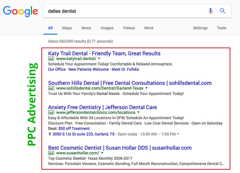 Dallas Dentist PPC Ads